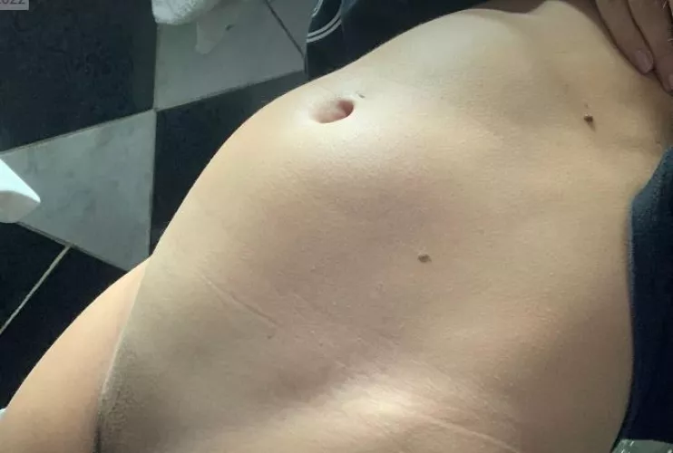 Eating pasta leaves me bloated like this by julijulibb