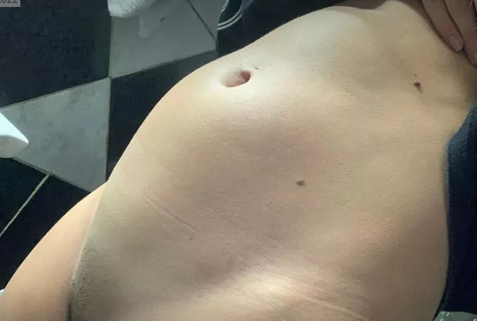 Eating pasta leaves me bloated like this posted by julijulibb