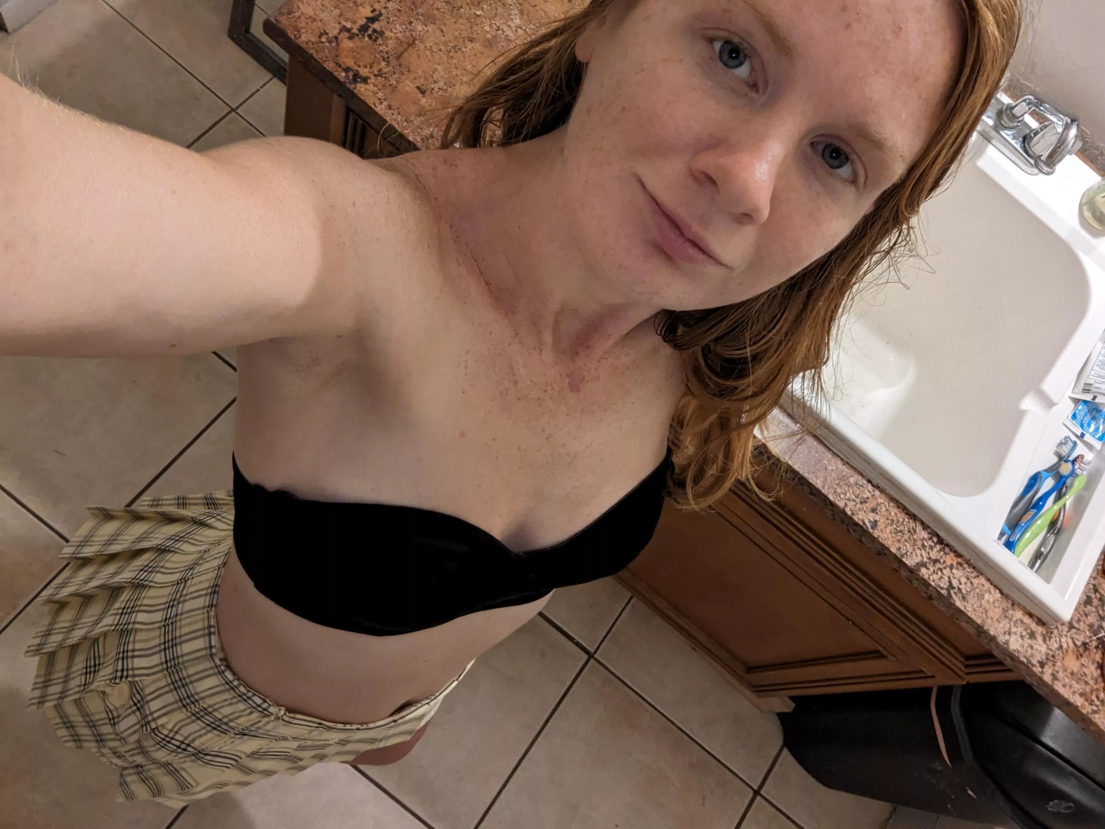 Freckle-infused fireball posted by Redlilyrose