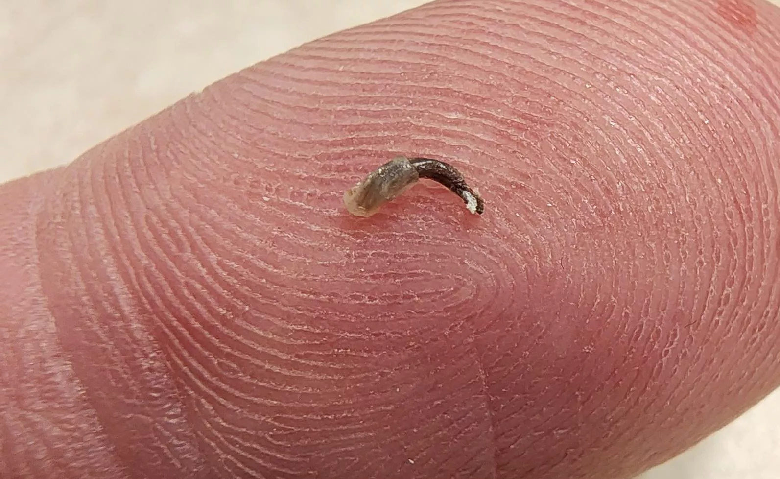 I just pulled this monster out of my cheek. posted by beerfarm243