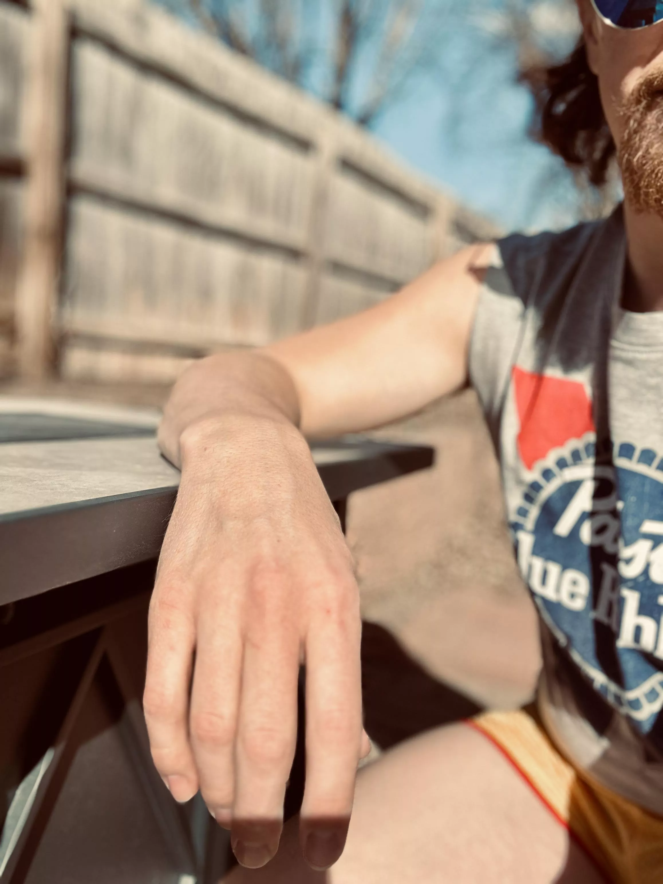 My arms need some sun! posted by beerzNbriefz