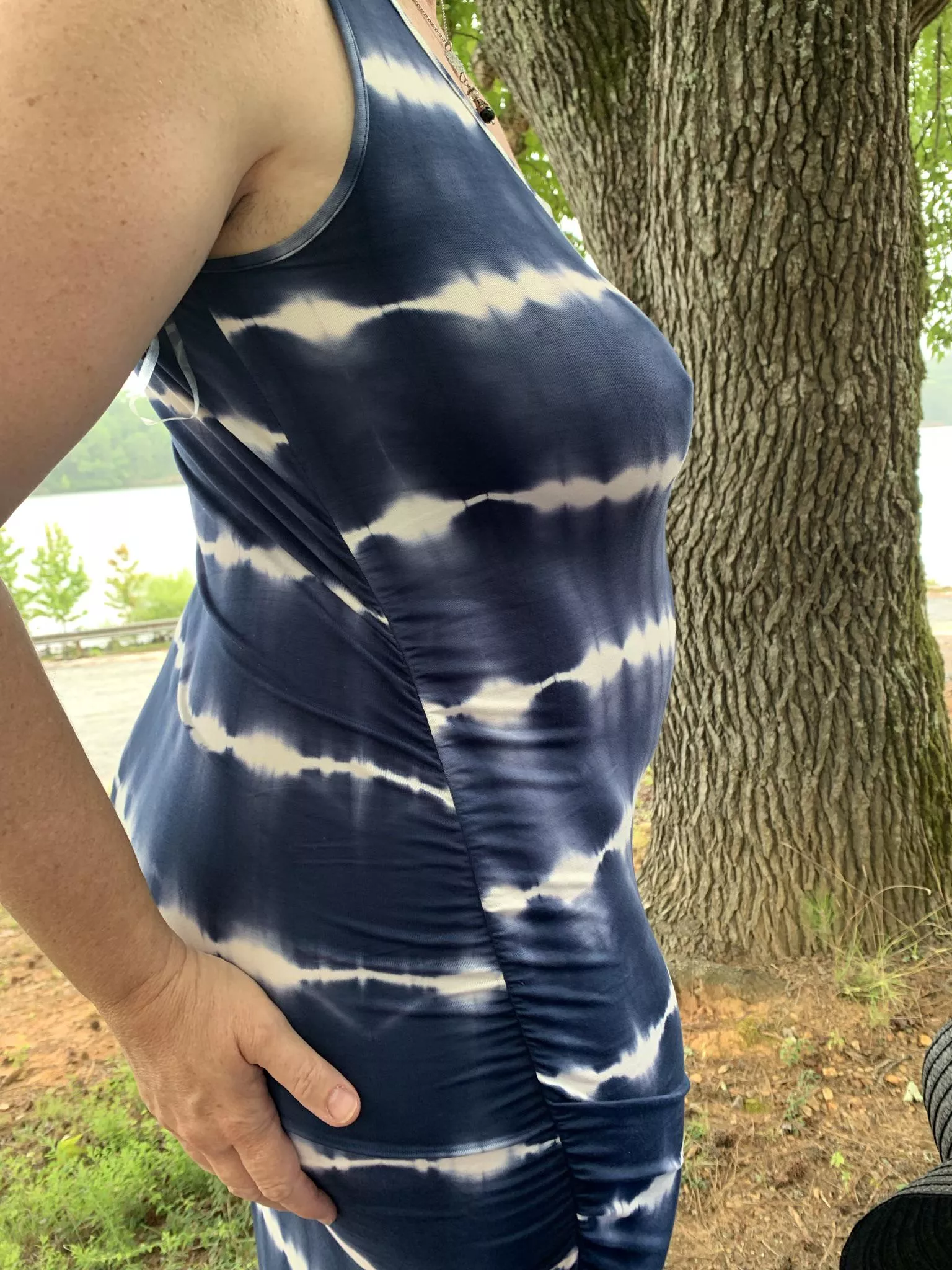 Her sun dress got some looks at the public park posted by Frisky_Vanilla