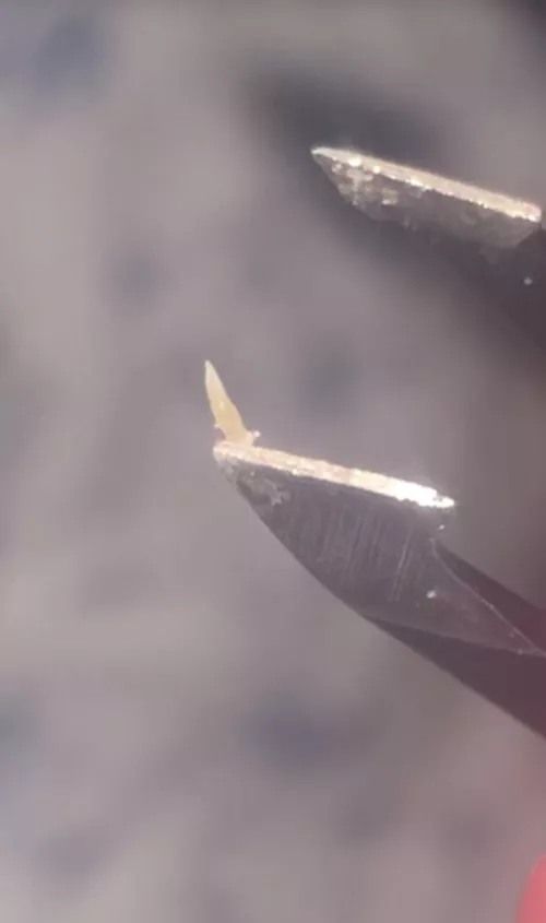 Pulled this blackhead out of my stomach. It always comes back in the same spot by Dry_Masterpiece_4921