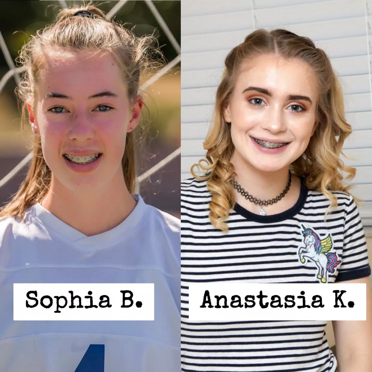 Which brace face would you glaze? [2] posted by Mysterious-Phrase885