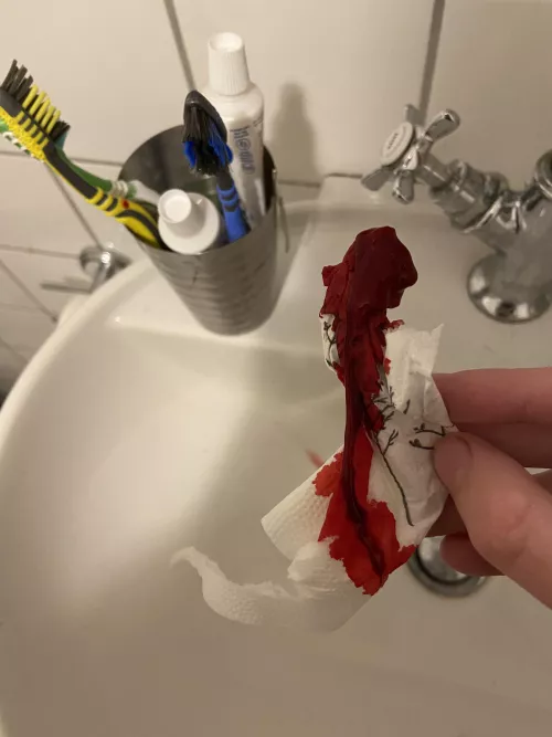 Pulled This out of my nose during a mighty nosebleed by Pastapalads