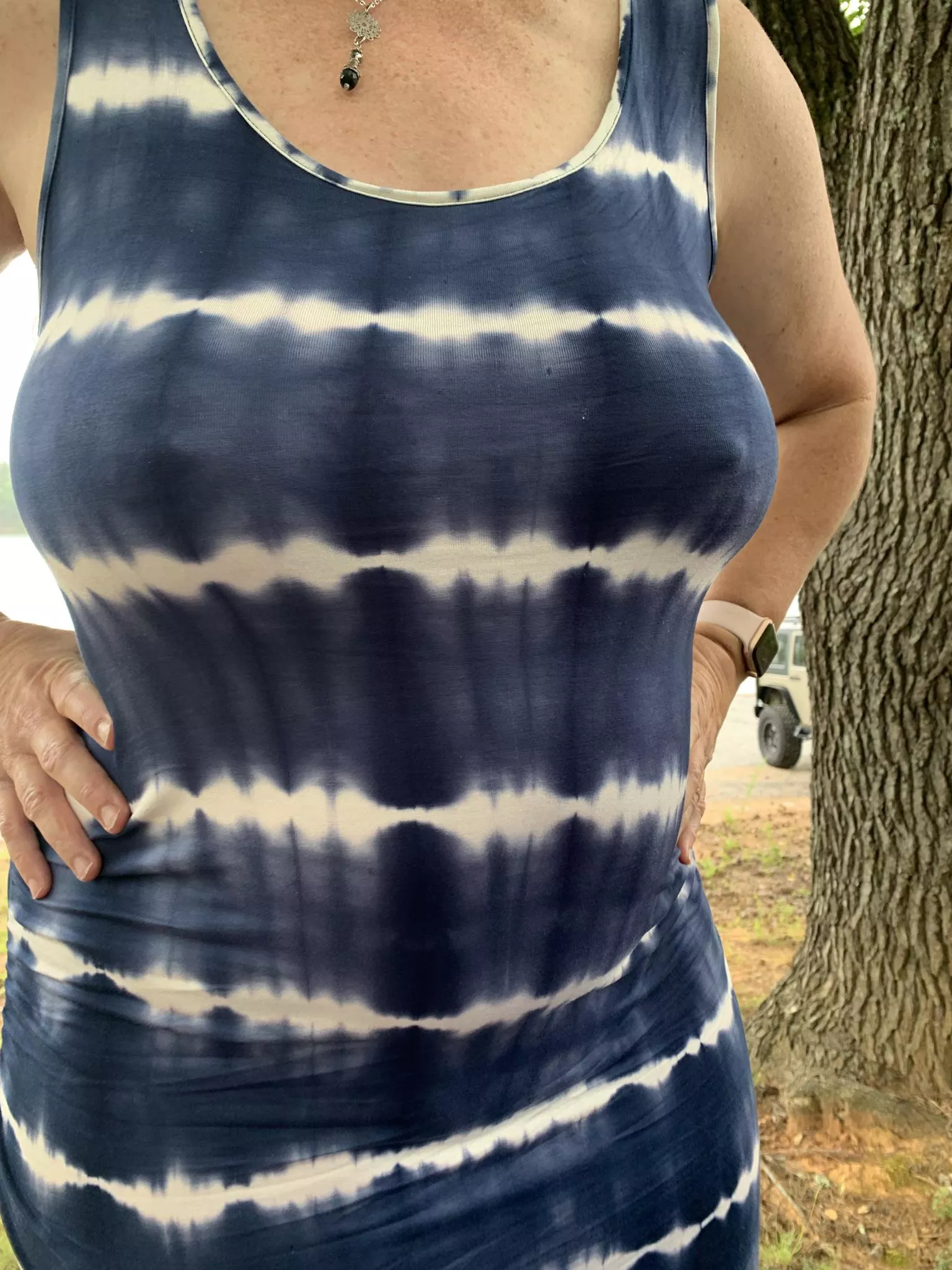 Tie dyed dress cant hide them posted by Frisky_Vanilla
