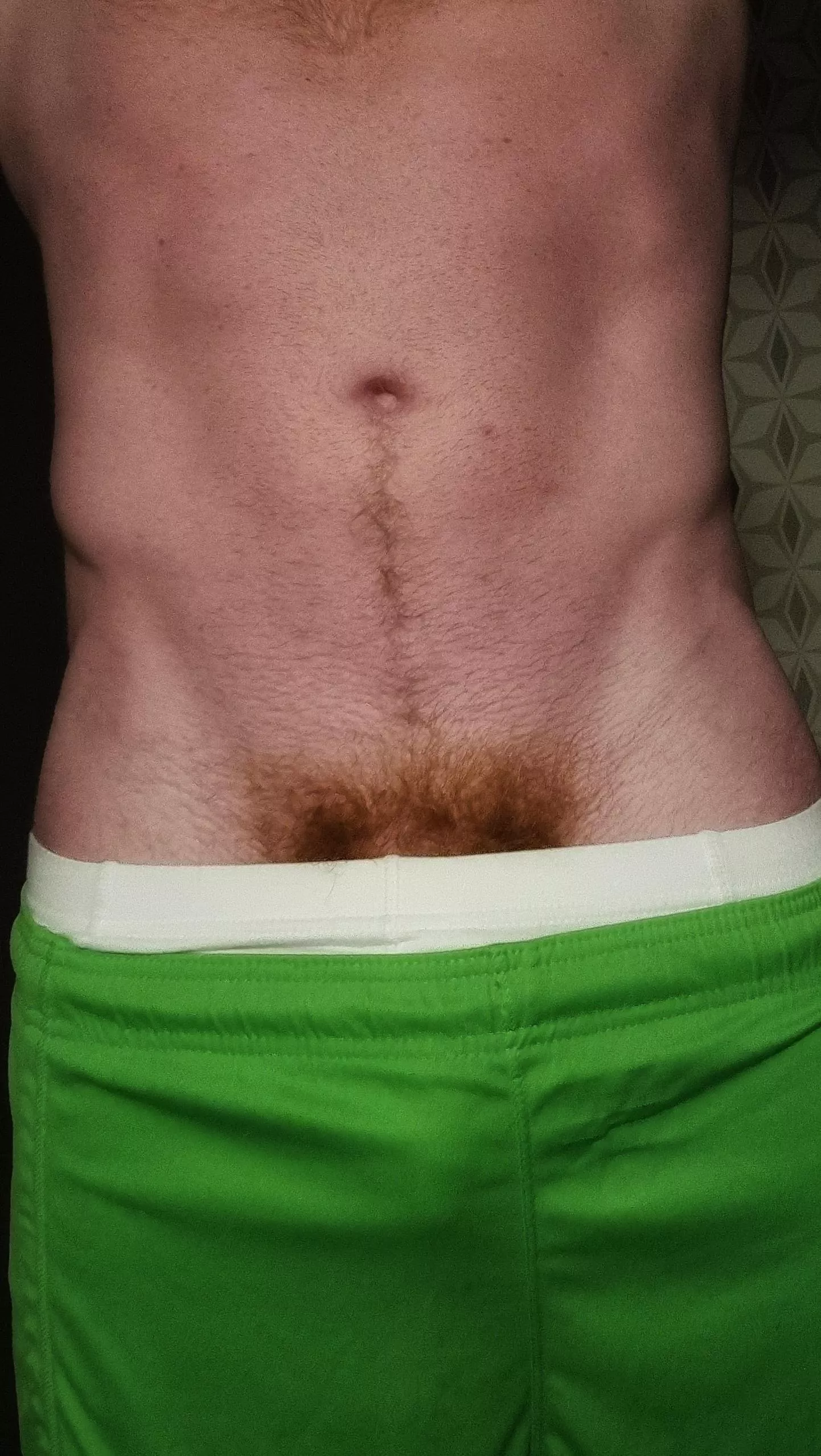 Needs more gold for St Patrick's weekend ☘️ posted by Fireshine91