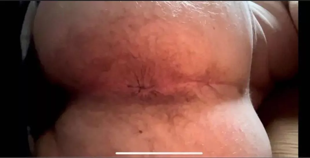 Tongue 👅, Finger 🤞, or 🍆😳 posted by King_Cake69