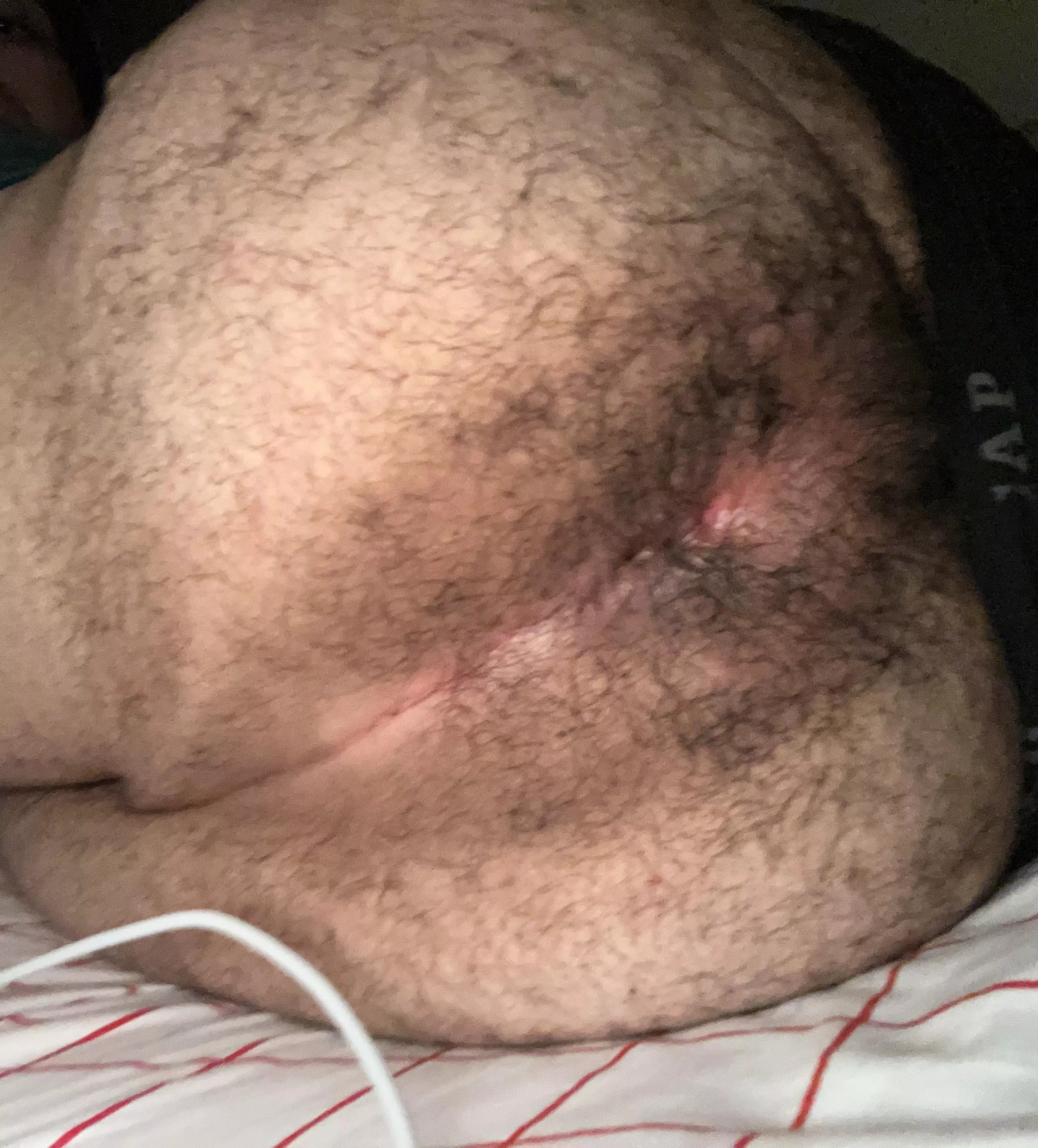 20 hairy chubby bottom add my snap js80712 posted by Savings_Bottle_9904