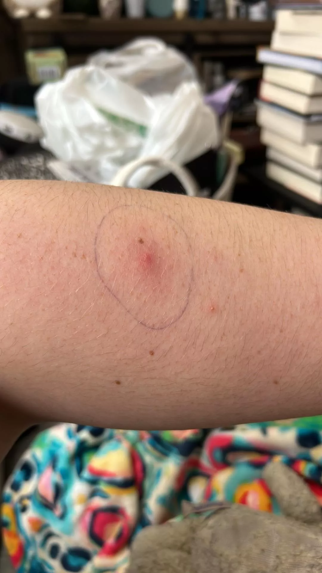 Now.. The Waiting Game  posted by ThatArtisticMoose