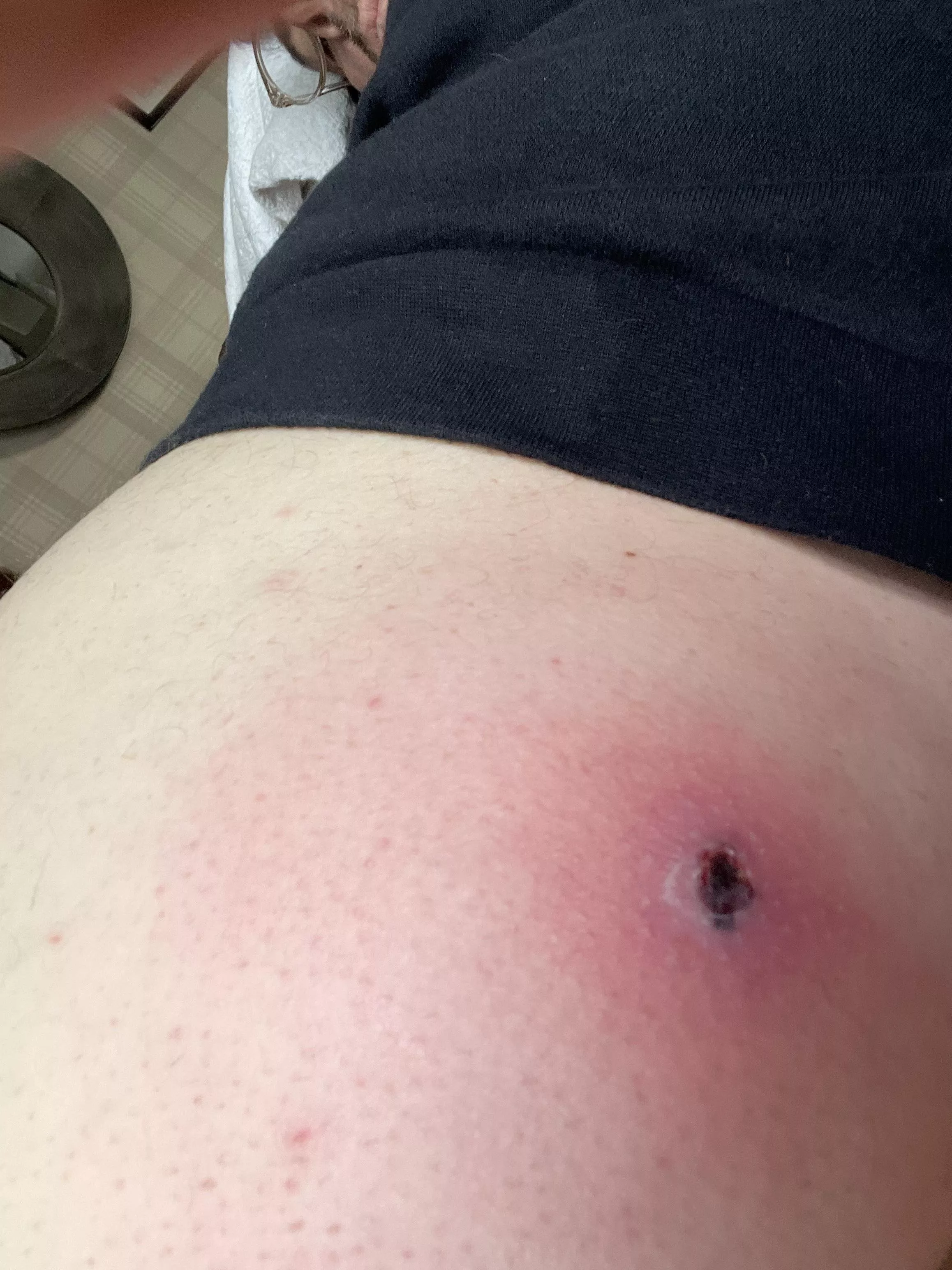 Will this pop? What is it? posted by LastAd6768