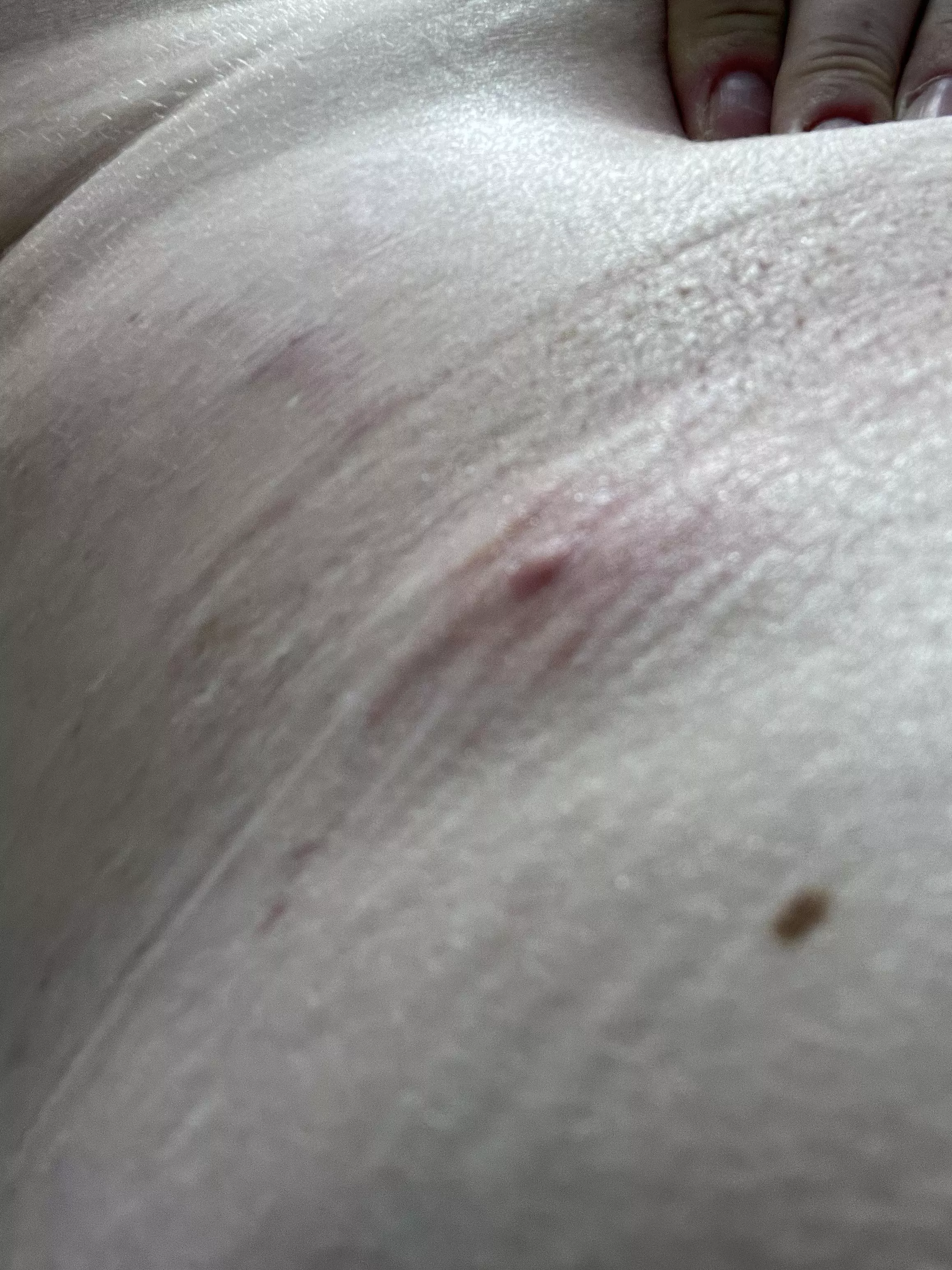 waistband monster is starting to show it's head. I wish these weren't so deep. it'd be nice to pop it and get it over with. posted by clezuck