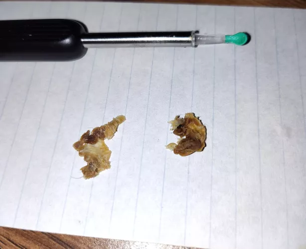 Ear gunk removed! Best $5 I have ever spent lol by Slippery_Molasses