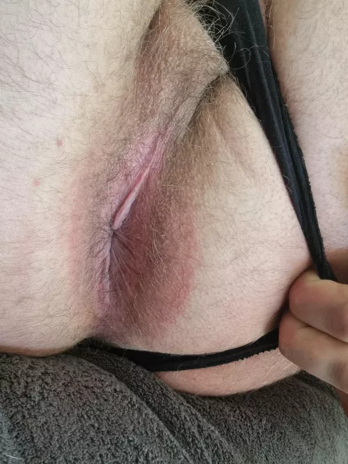 Hair is starting to come back  by clearwaterlizard