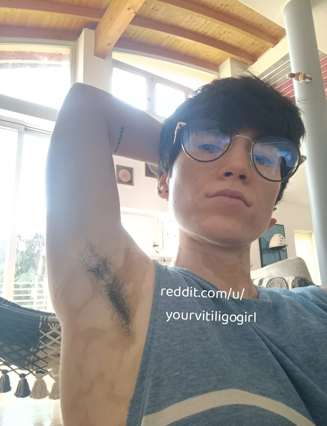 Play with your boi posted by yourvitiligogirl