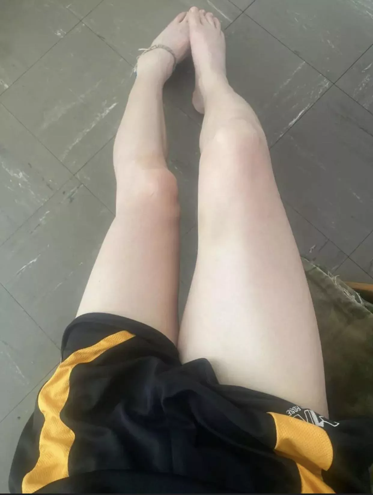 Boy legs xx 18 posted by benfriendben