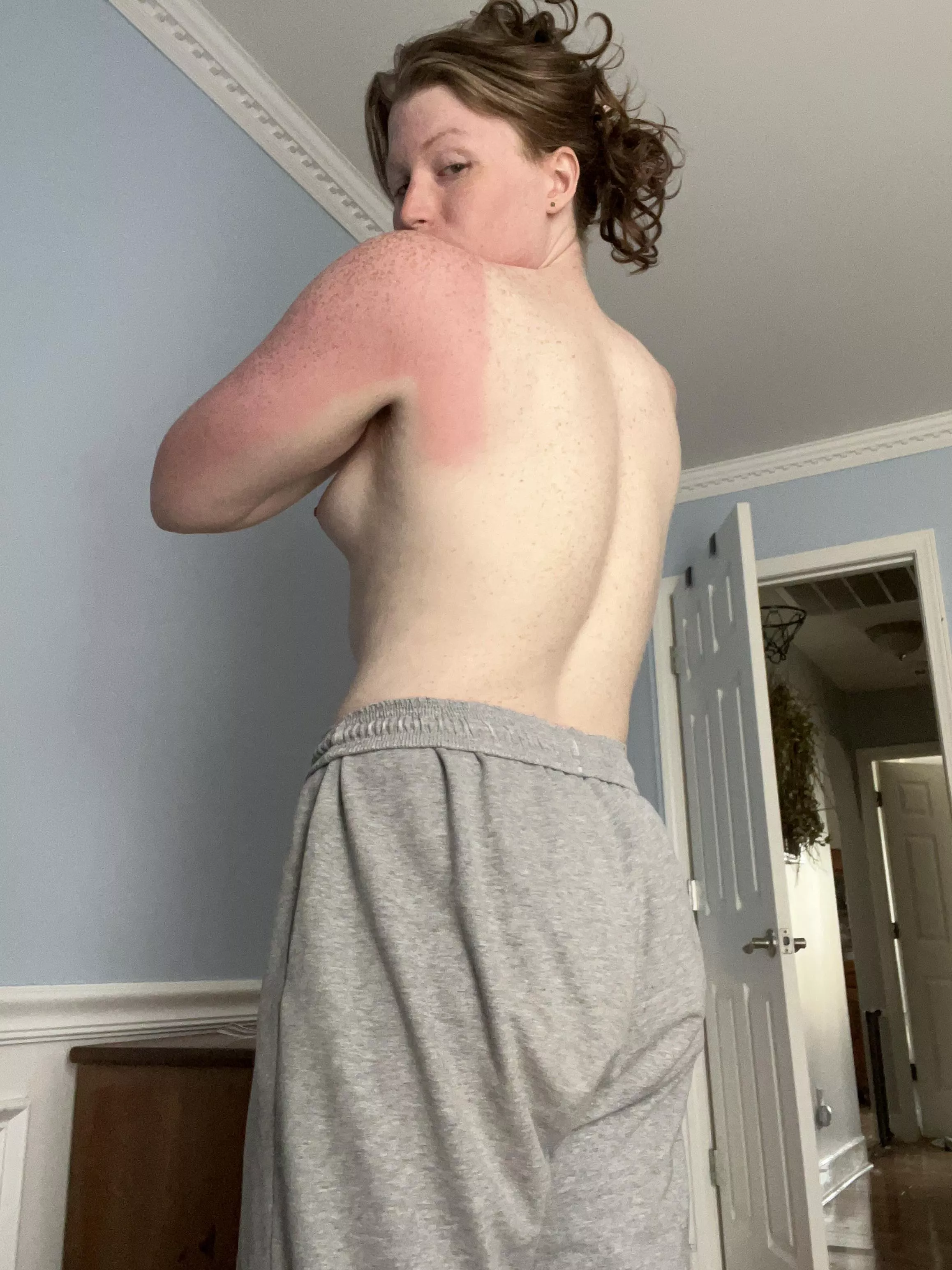 got some sun this weekend posted by kalliope999