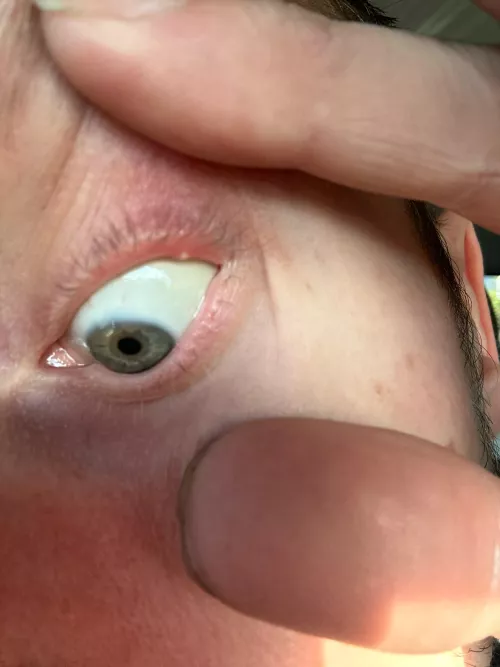 It’s on my eyeeeeeee by solidmurda