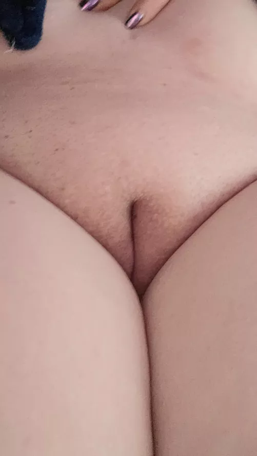 Kiss it? by Revolutionary-Track7