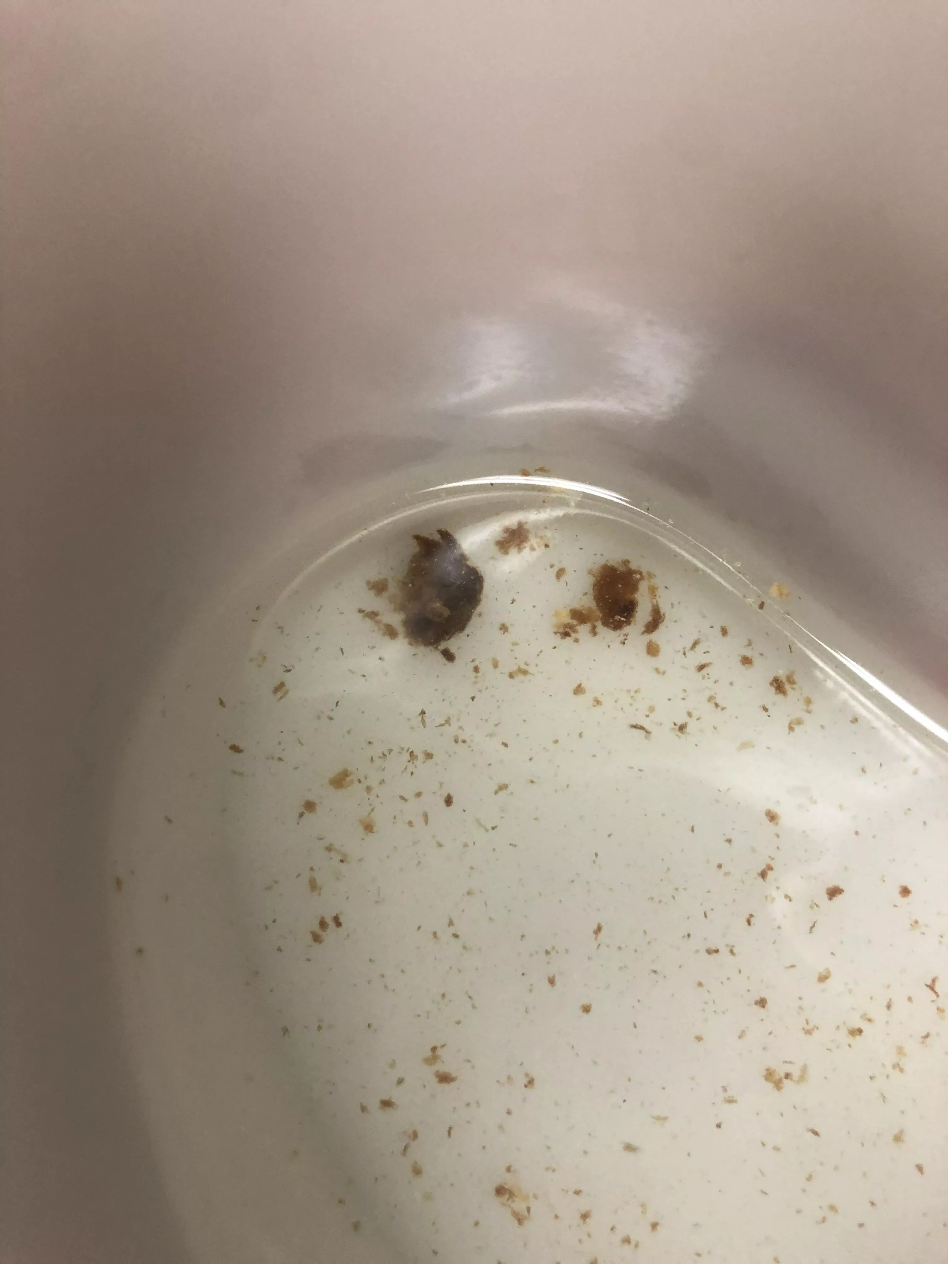 My ear was clogged for days so I had my ear flushed and this came out 🤢 posted by JMies93