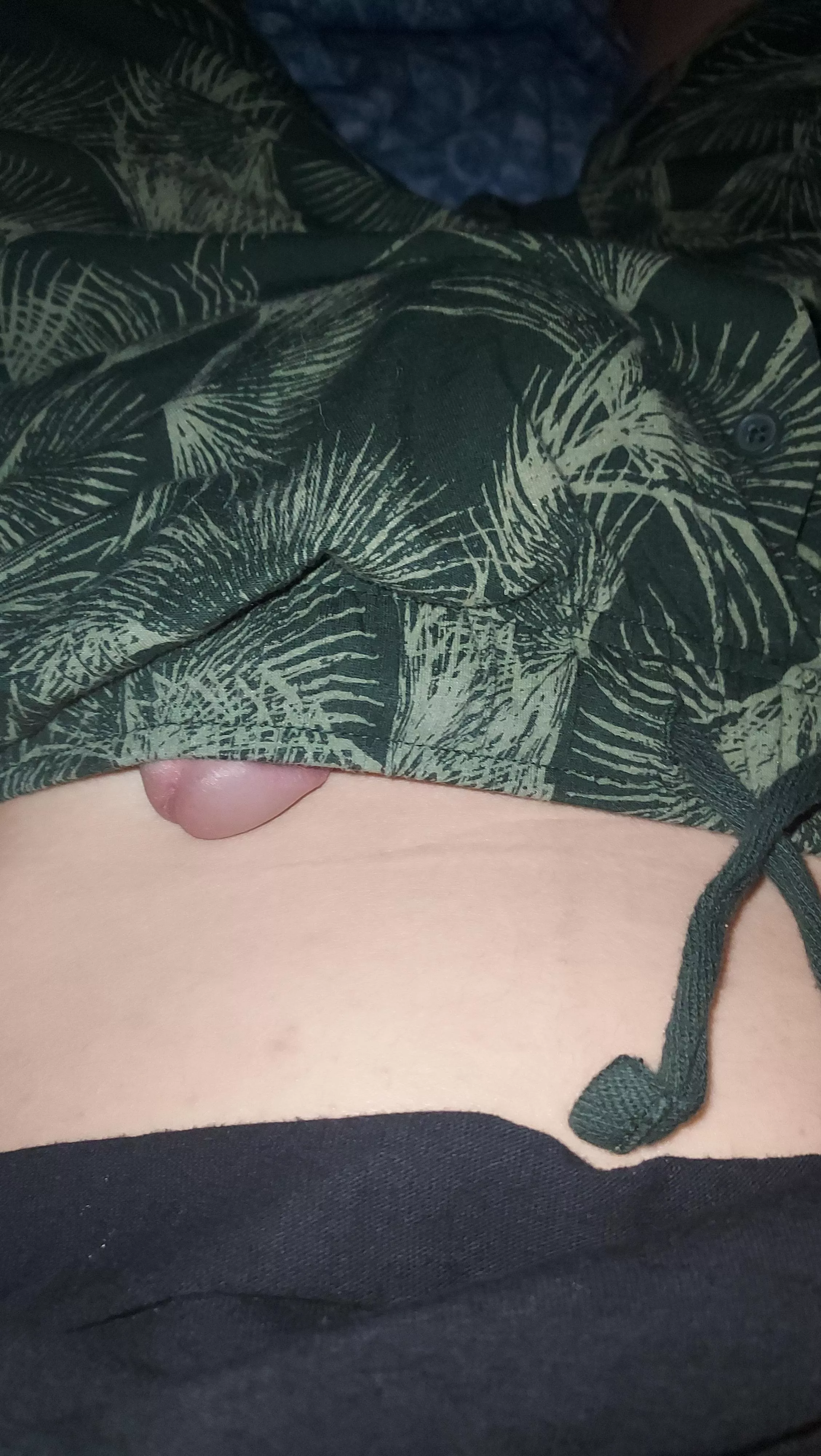 My tip is creeping out a little who wants the rest  posted by Least-Produce5295