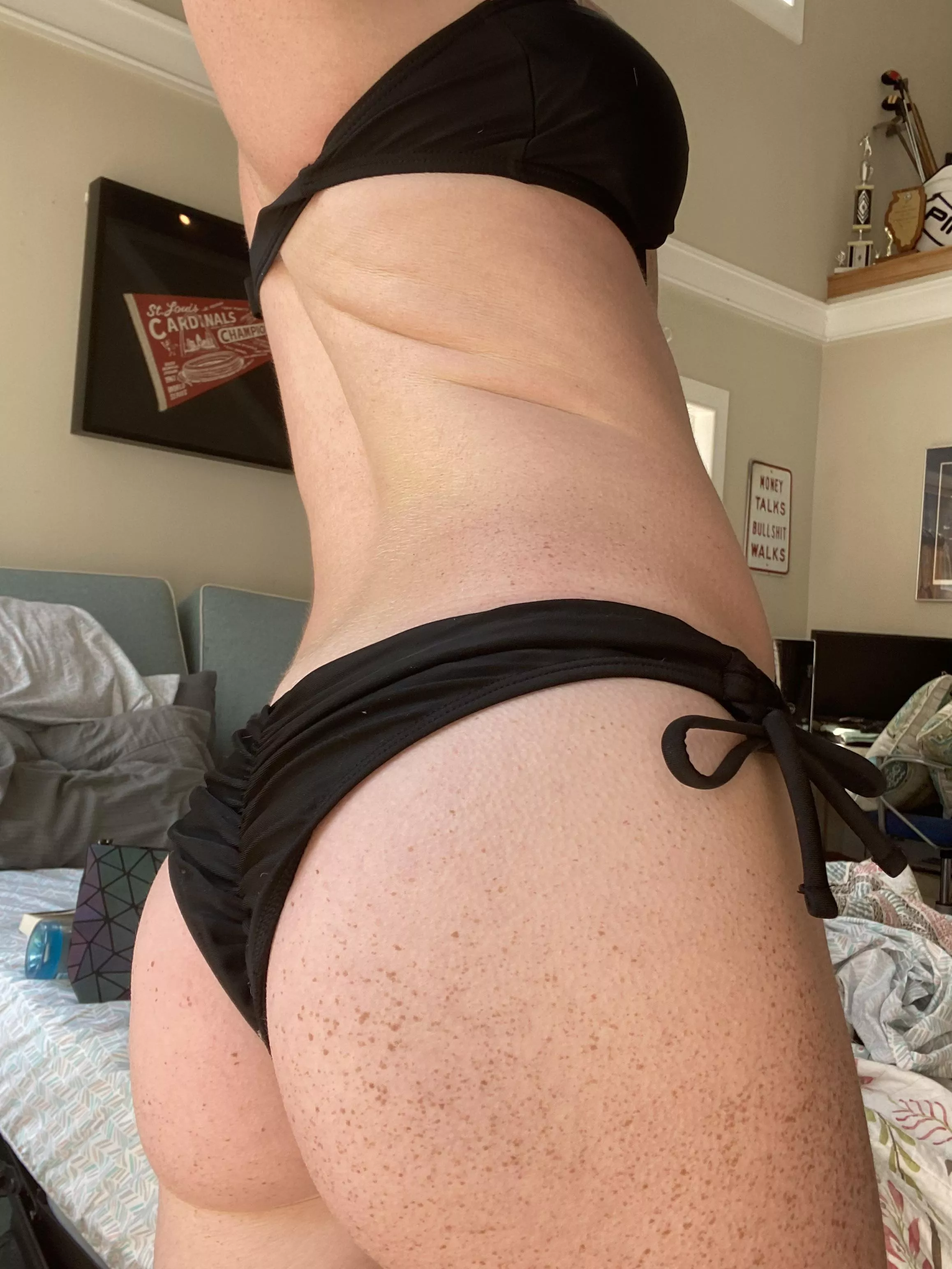 Do you like freckles  posted by Nervous_Wrongdoer_82