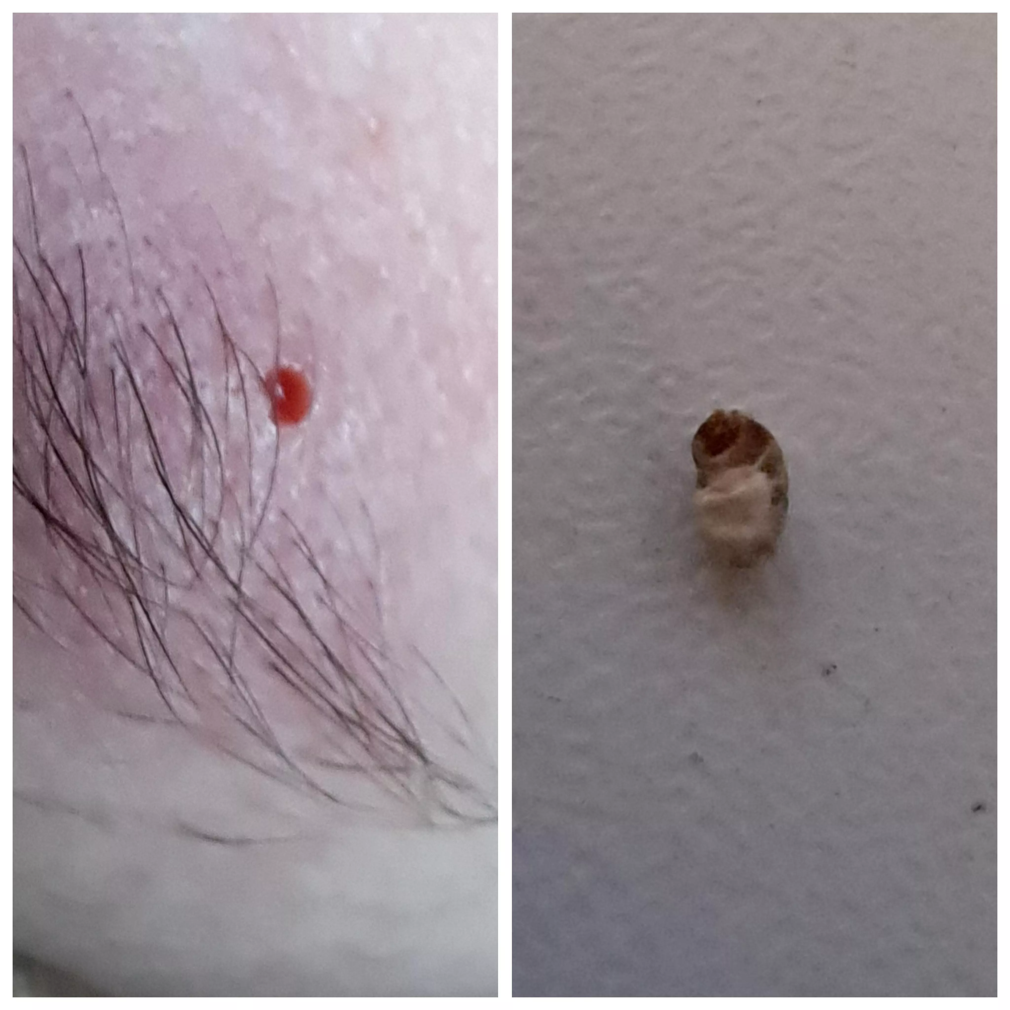 Eyebrow pore of Winer posted by Lonely-Grape1279