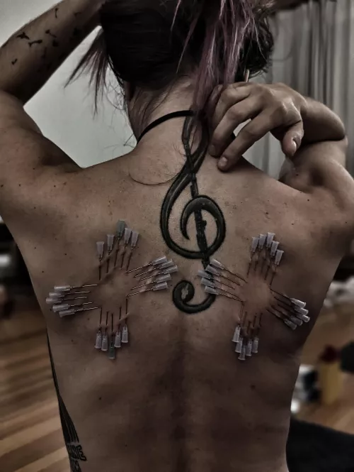 needles in movement by semenawa