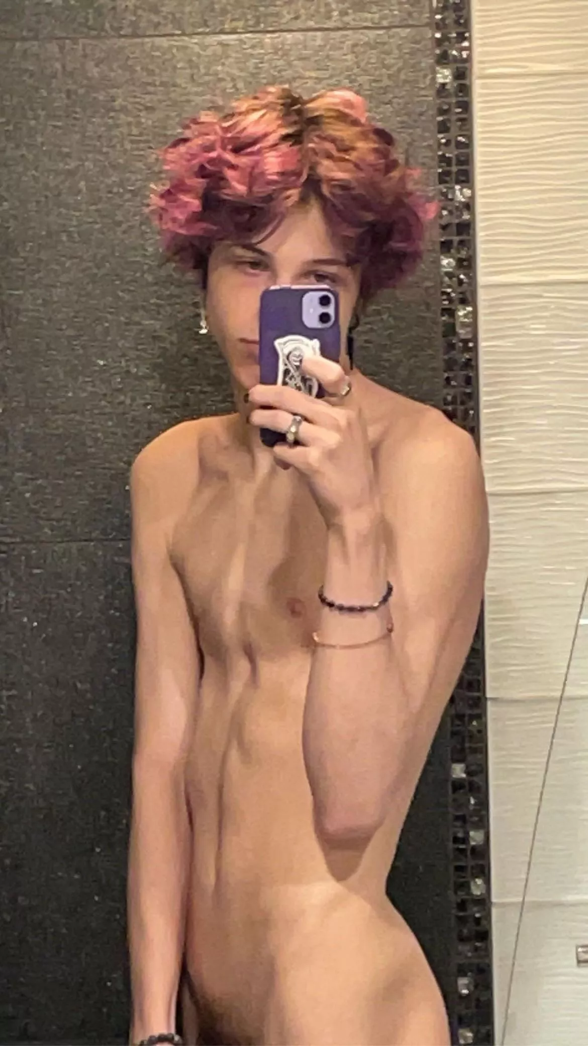 Old pic posted by Ok-Cardiologist-5362