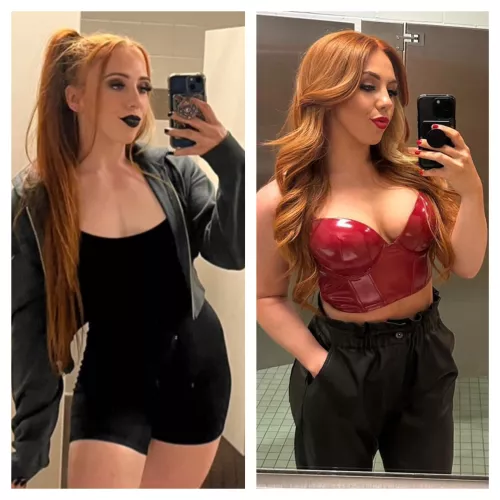 Isla Dawn Before/After Boob Job by chachacha32