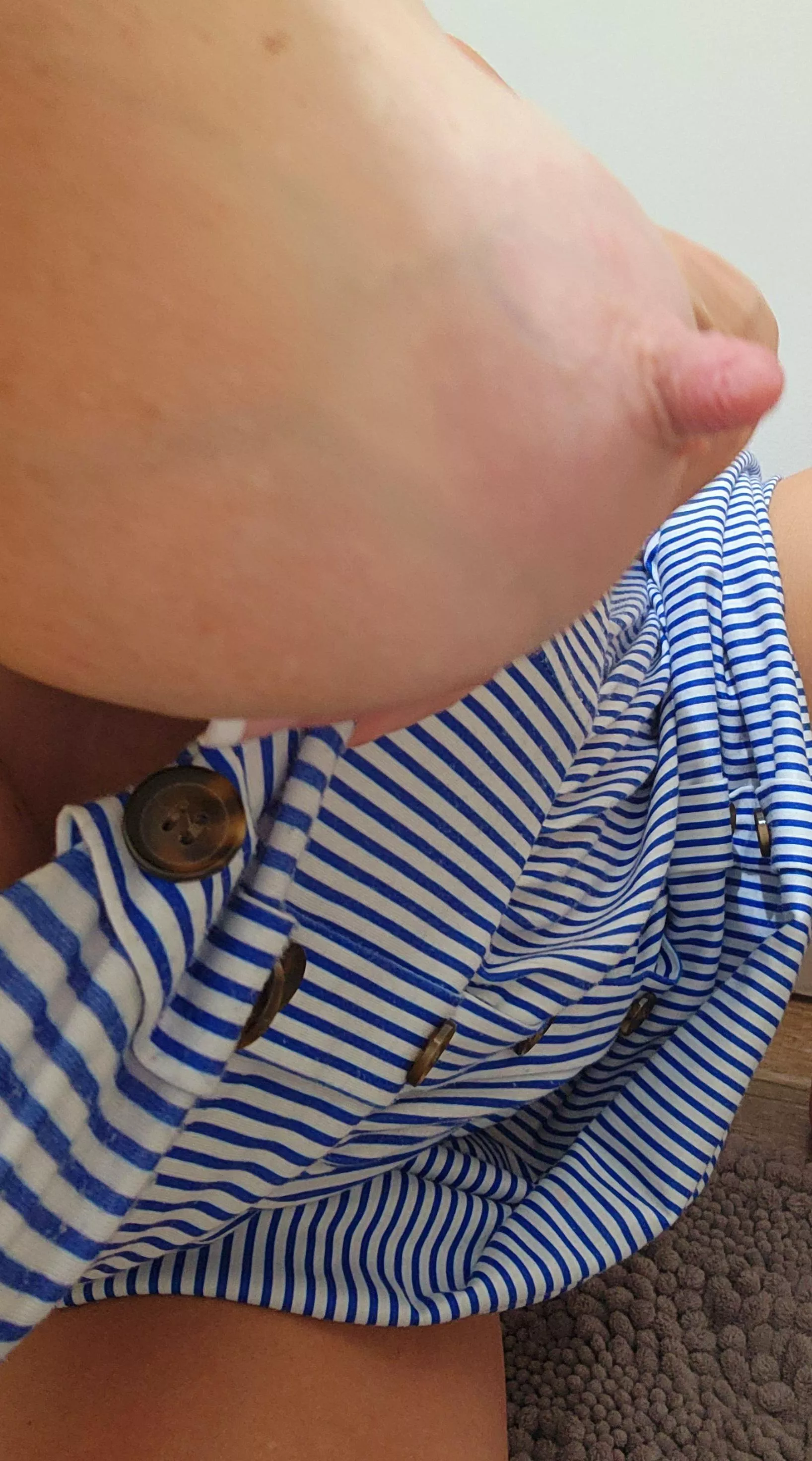 My beautiful veins go with my dress today posted by PippasMommyDiary