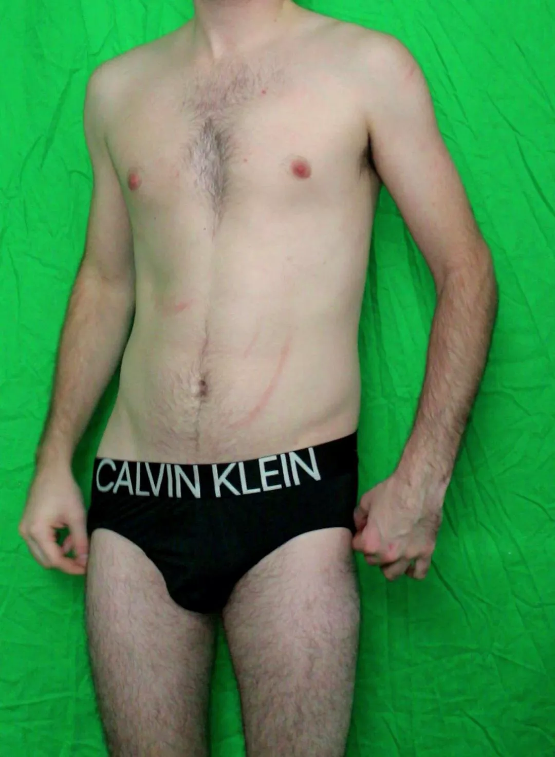 Preparing to take them off  posted by Willybriefs