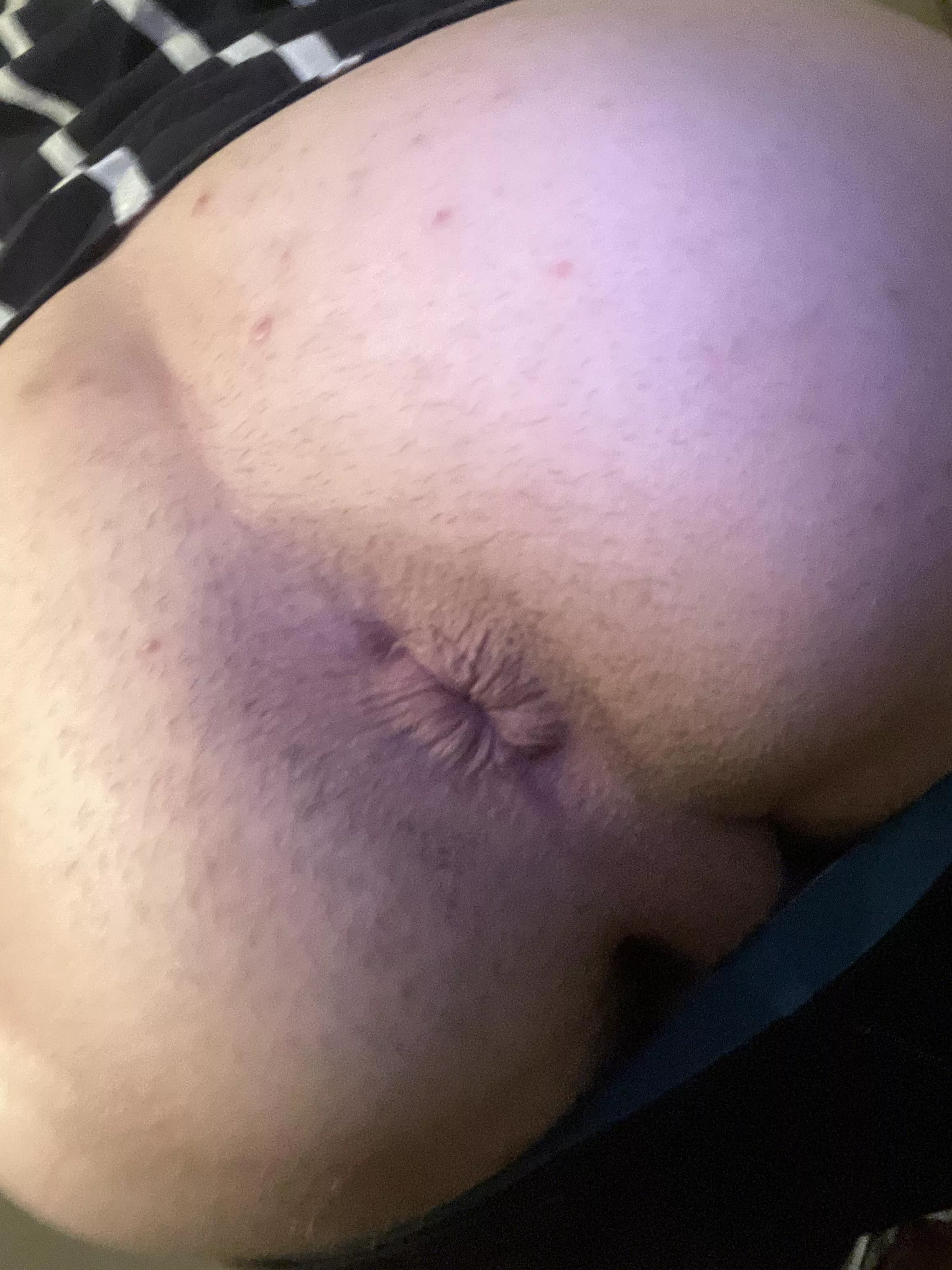 Eat my Ass (19M) posted by ashercatergory