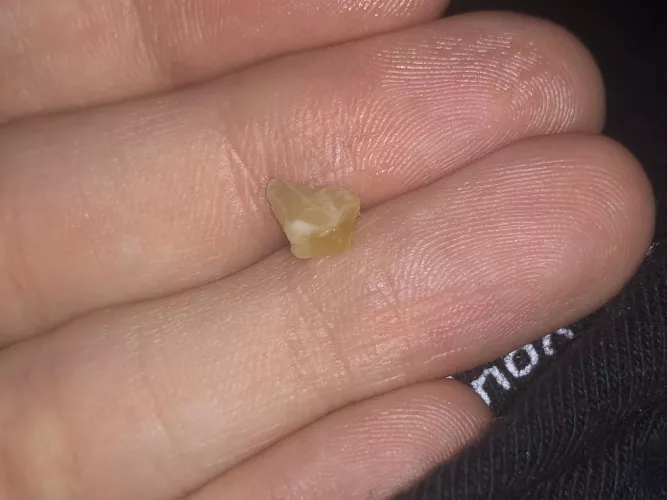 this just fell out of my nose by nonogender