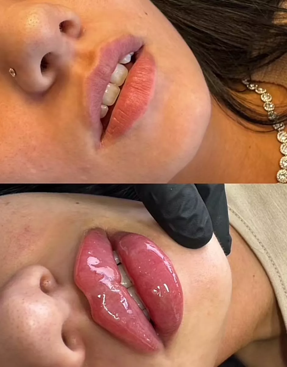 When you get filler, get Russian technique! posted by anonyyyymuser