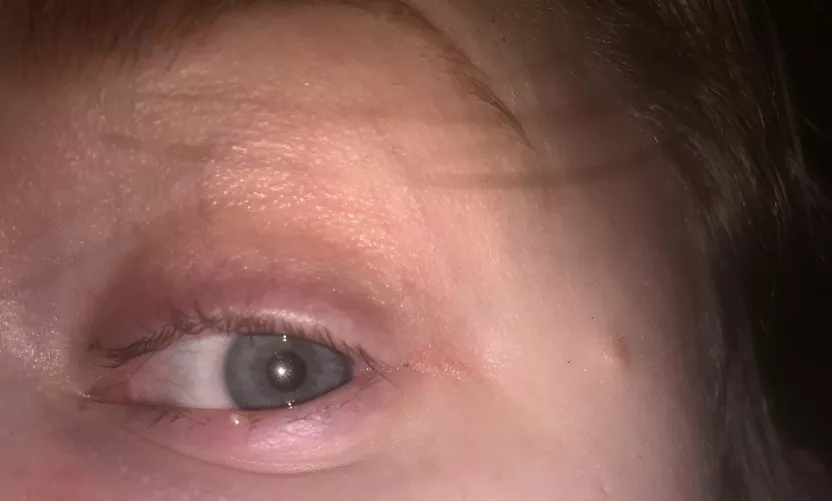 How forbidden *IS* “Forbidden”? by bford1026