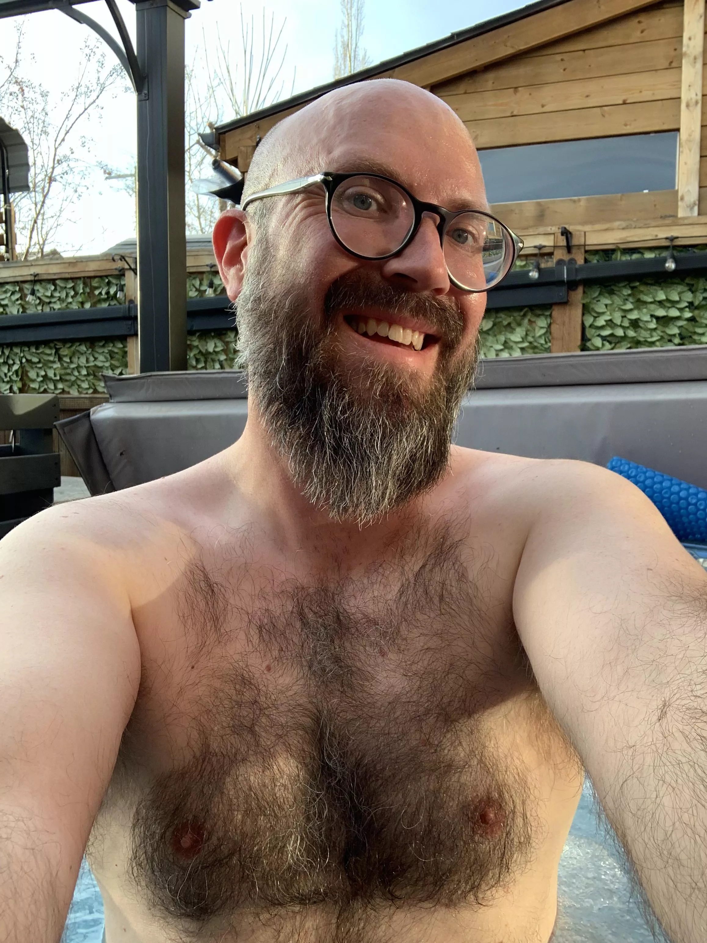 My hairy chest! posted by EvenNefariousness979
