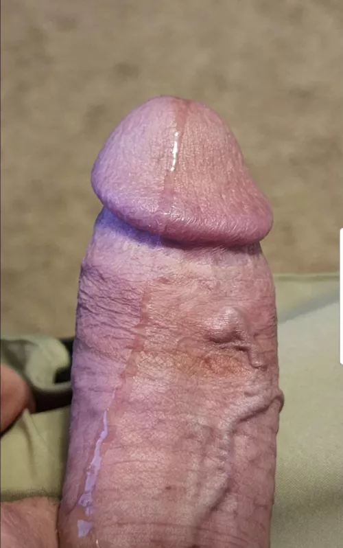 Anyone want to get hit with my poison arrow? by Harry_Wrecked_Em