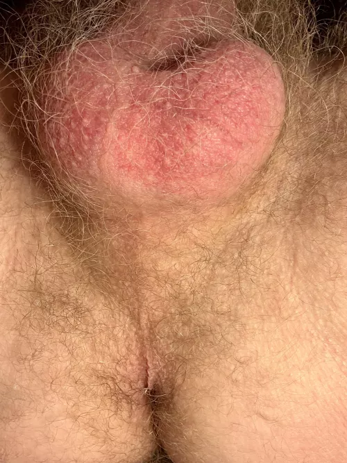 Hairy balls or hairy asshole? by OneLove__420