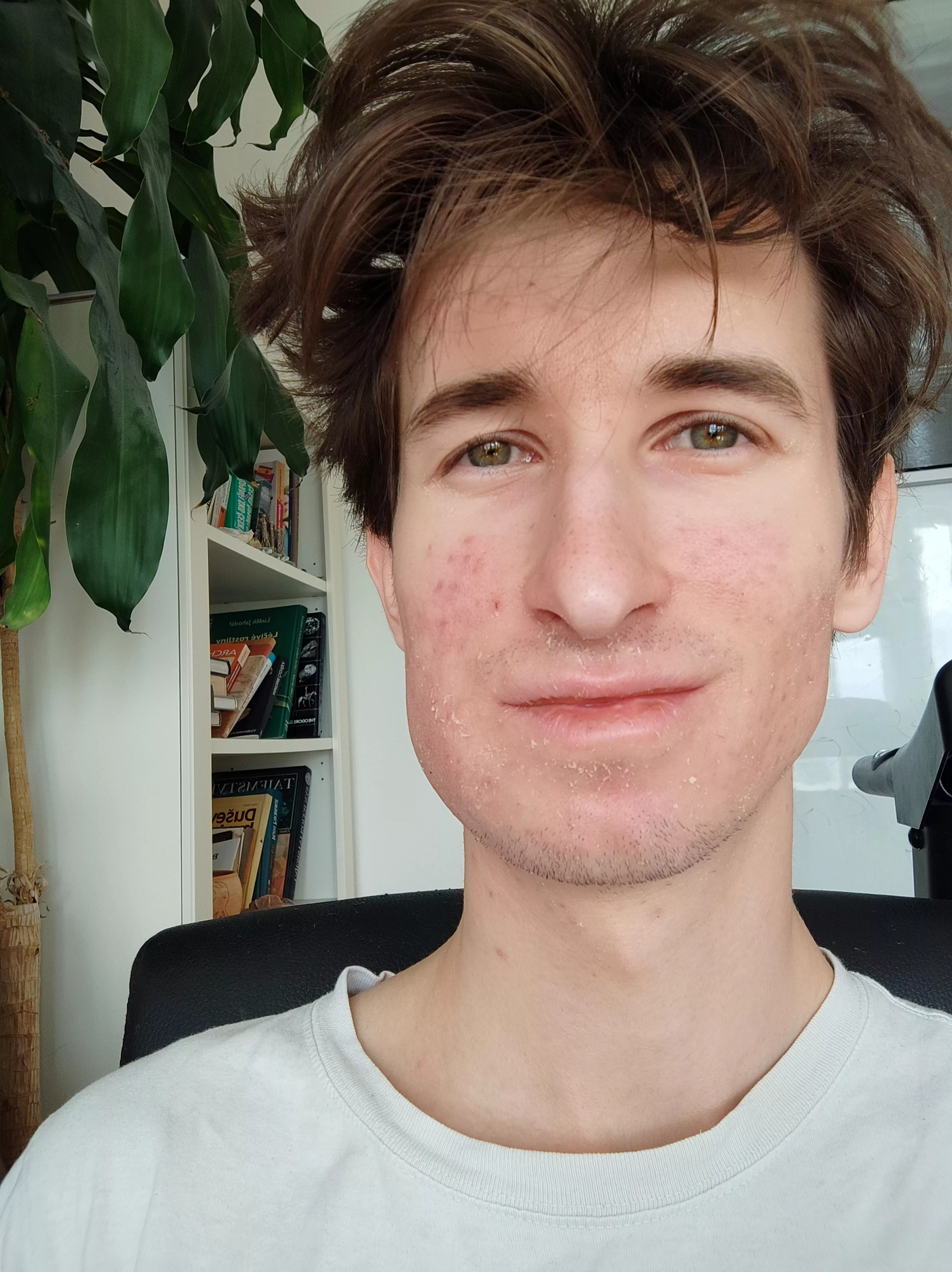 After wisdom tooth extraction 🥲 posted by kubapp21