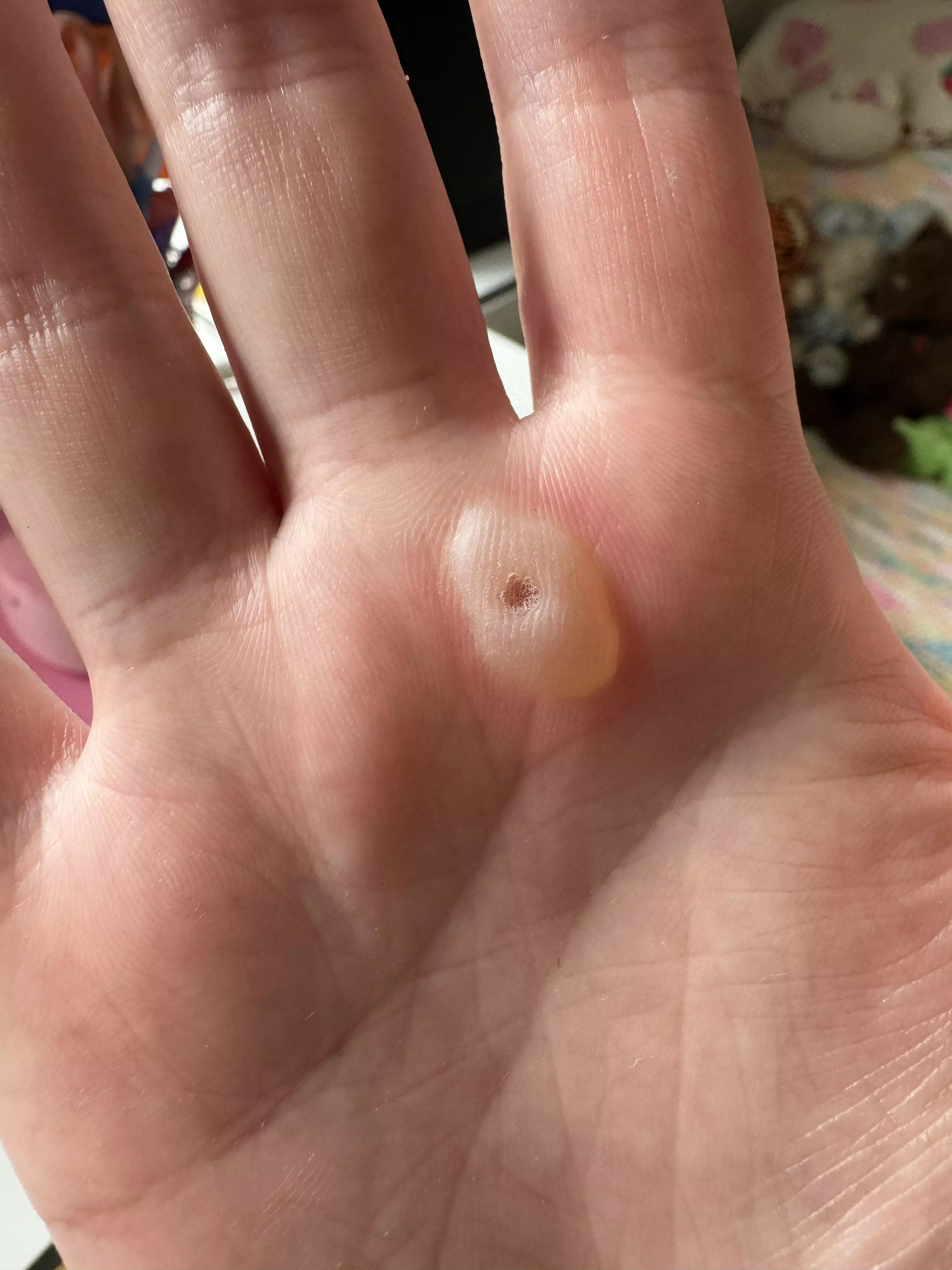 Forbidden Palm Blister posted by katiesma