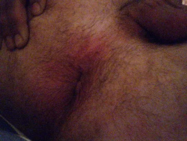 My hairy hole posted by Sad_Jackfruit_145