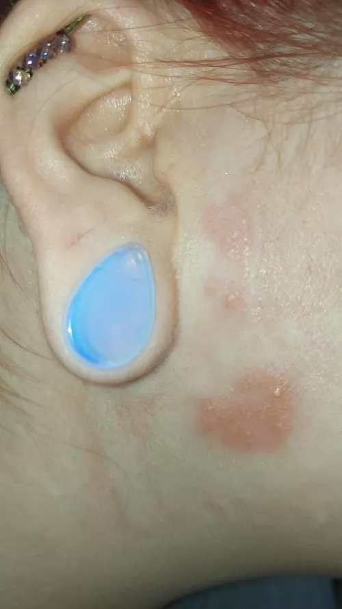 My shingles forbidden pop. by MasterBiscuit8008