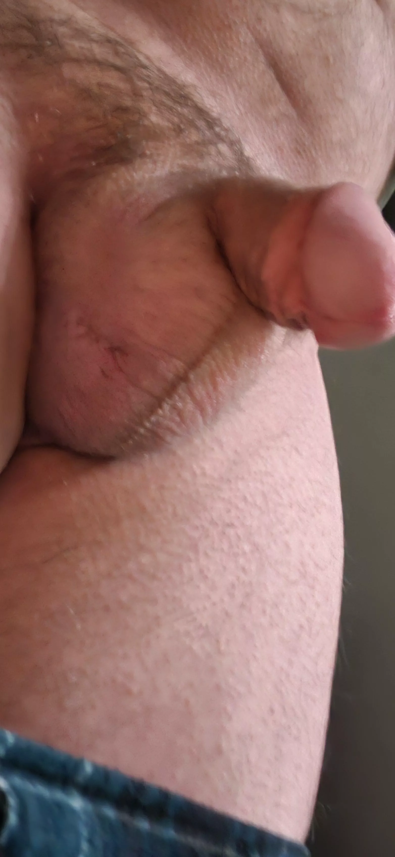 My small, hairy softie. I'd shave but I don't need another scar or deep cut. posted by hornyinthedesert