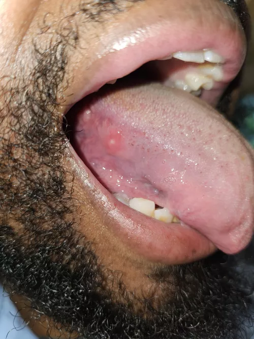 First time this has happened by madthunder55