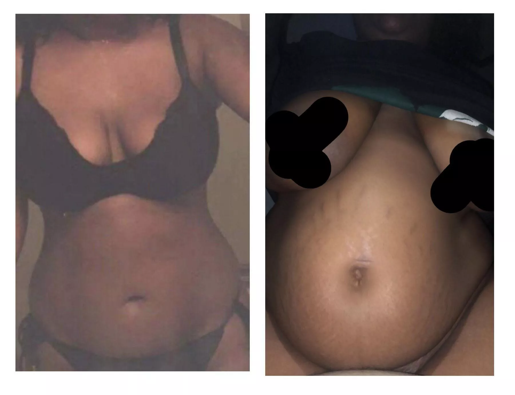 Mesmerized by how wide my belly button got 🙄 Im also now covered in stretchies 😬 posted by Urfavesnack5699