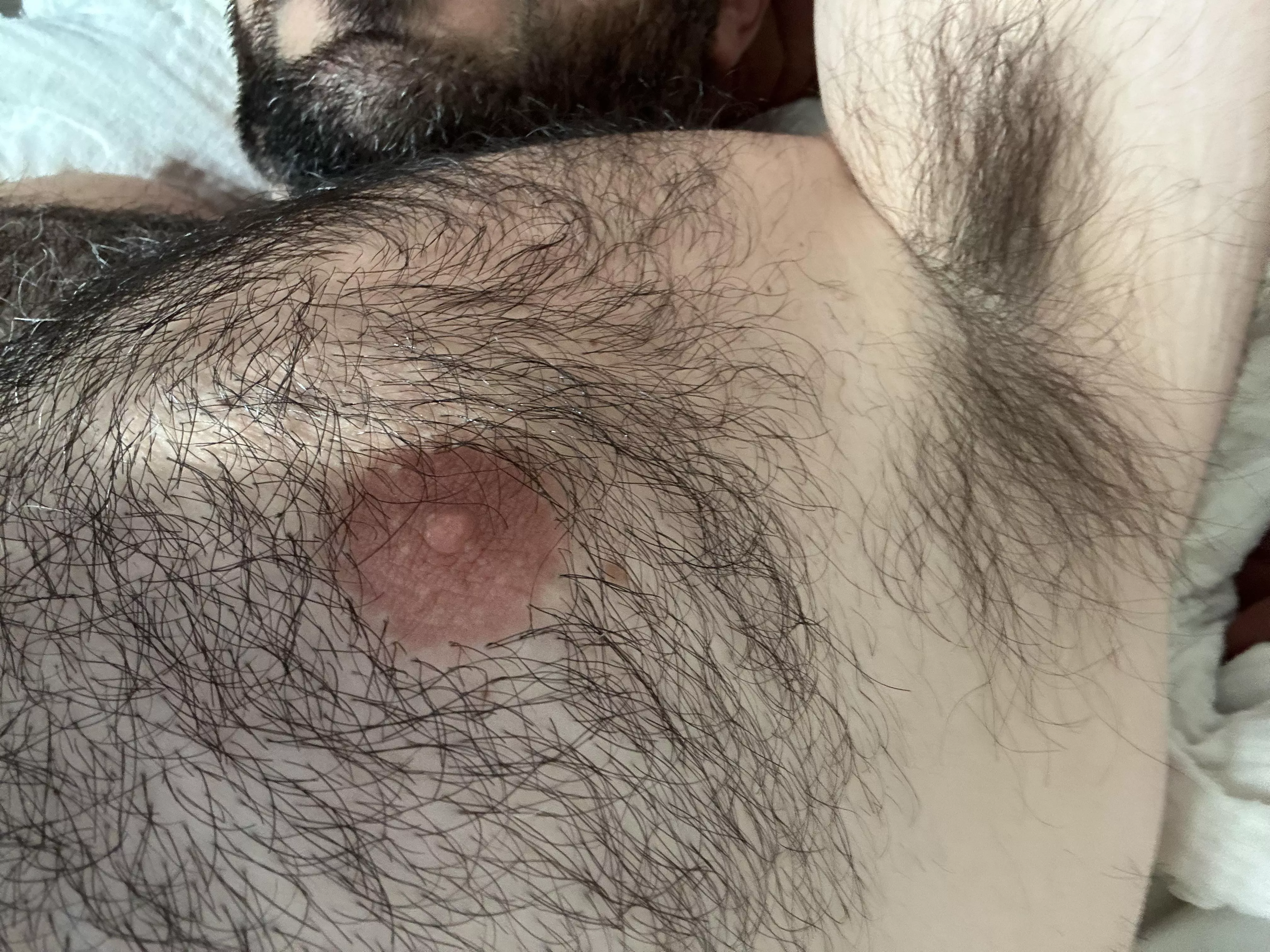 Musky pits posted by Healthy-Magician-172