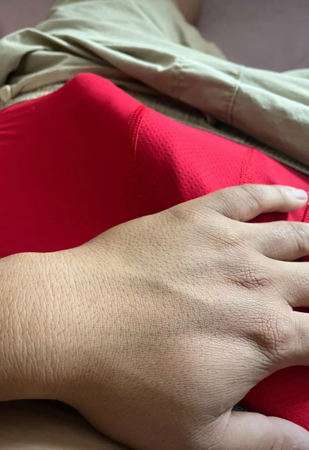 Bulging out posted by amazingleroy