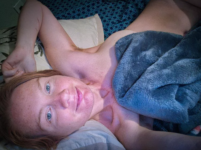 Fiery fable of freckles by Redlilyrose