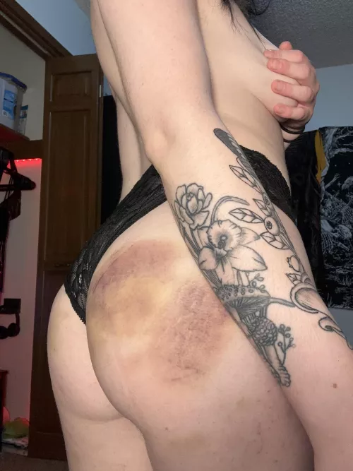 I had my first major impact session back in like October and ever since it’s been on my mind consistently. I just love being covered in pretty little bruises. They remind me of a galaxy. by Angel-puke